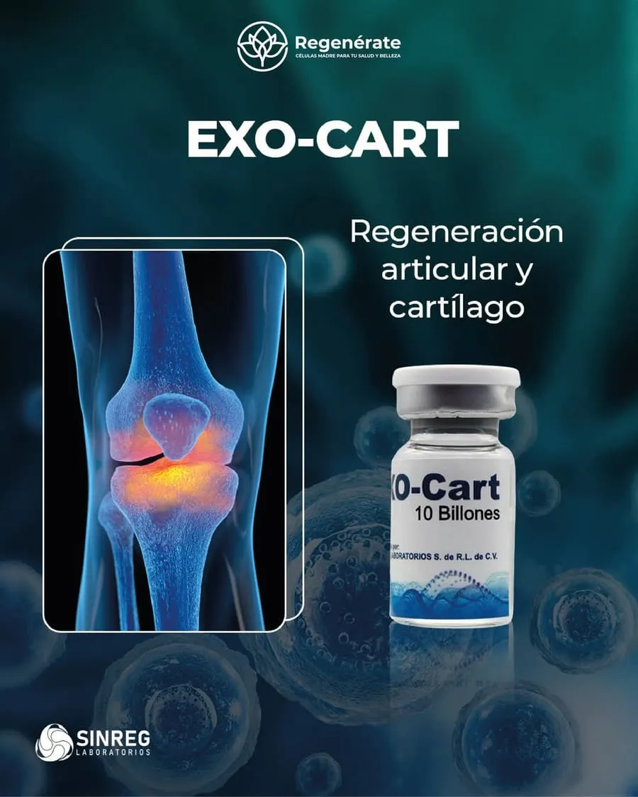 Promoción: exo cart